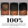 (plated) HAIR