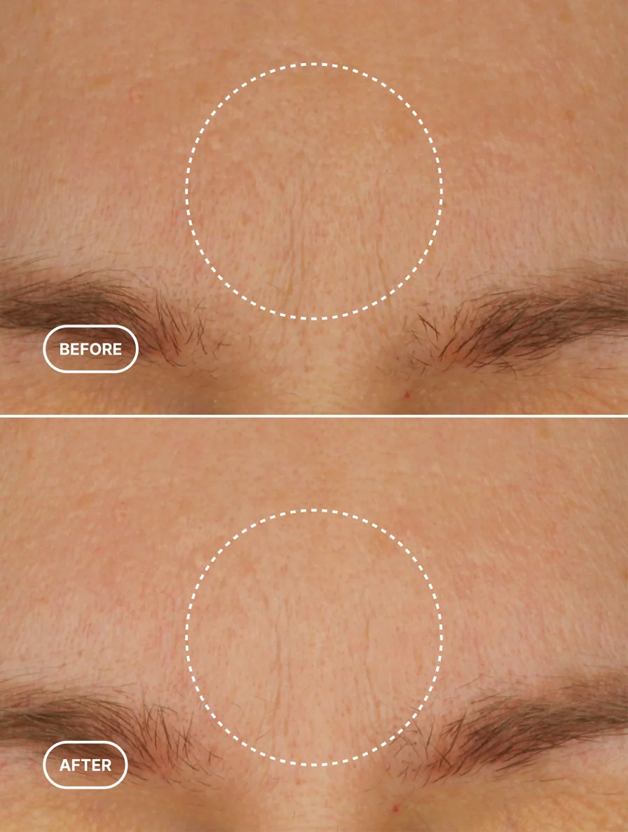Renewal Lift Moisturizer-Antiaging