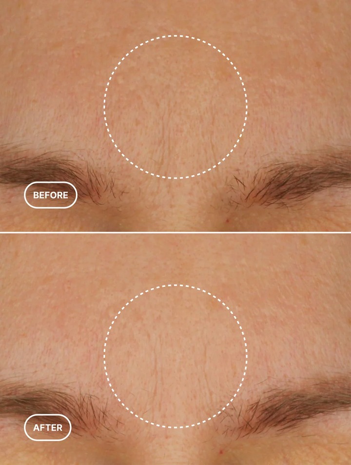 Renewal Lift Moisturizer-Antiaging