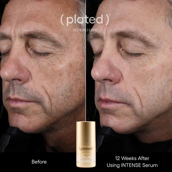(plated) INTENSE Serum
