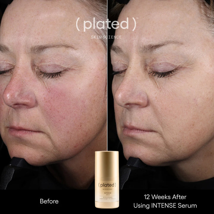 (plated) INTENSE Serum