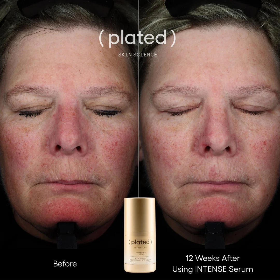 (plated) INTENSE Serum