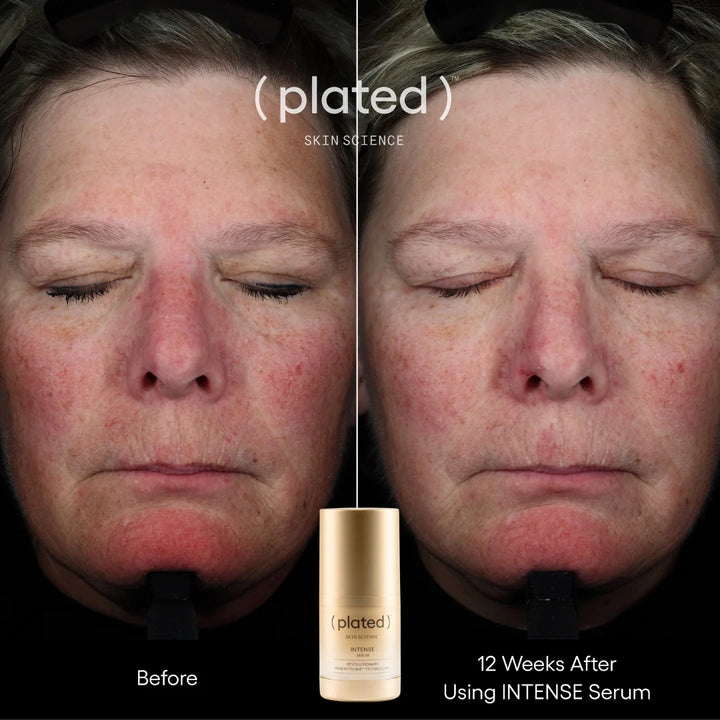(plated) INTENSE Serum